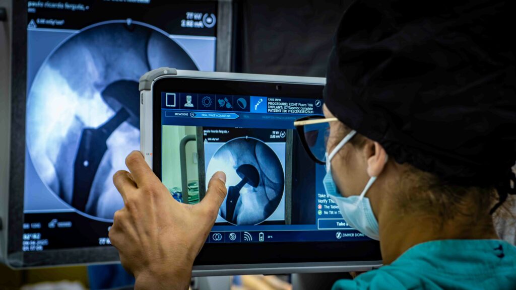Cirurgiã observa imagens digitais da prótese de quadril em tela durante procedimento com cirurgia robótica assistida.