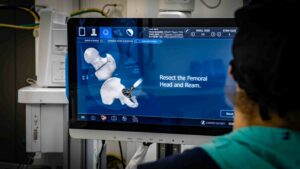 Tela de navegação cirúrgica exibindo a simulação 3D de uma cirurgia robótica de quadril, com indicação do procedimento de ressecção da cabeça femoral.
