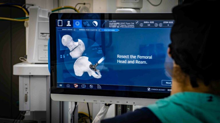 Tela de navegação cirúrgica exibindo a simulação 3D de uma cirurgia robótica de quadril, com indicação do procedimento de ressecção da cabeça femoral.