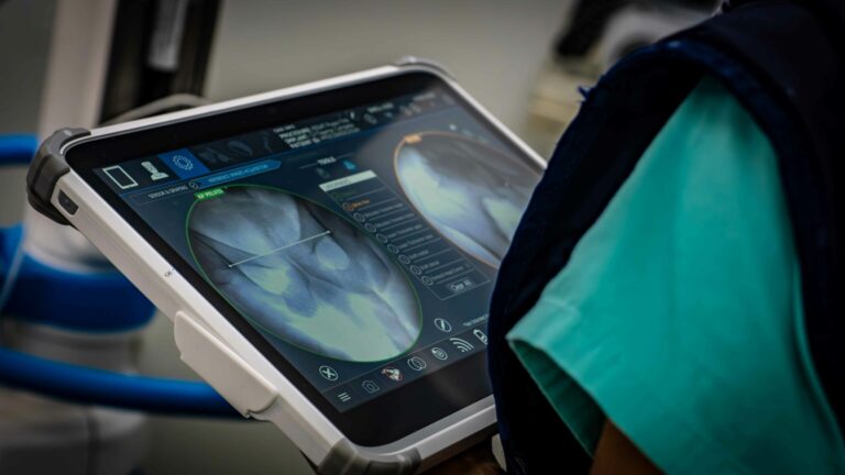 Profissional da saúde observando radiografias de quadril em tela digital durante avaliação clínica.