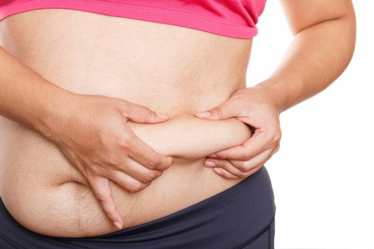 gordura abdominal